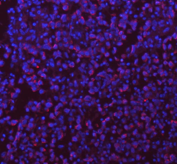 Anti-SASS6 Antibody