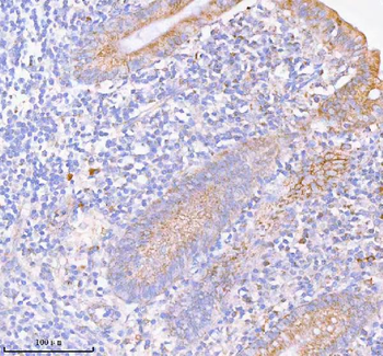 Anti-SASS6 Antibody
