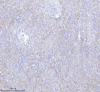 Anti-SASS6 Antibody