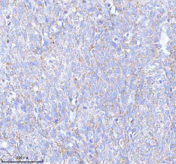 Anti-SASS6 Antibody
