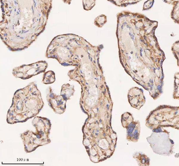 Anti-SAMD9L Antibody
