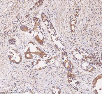 Anti-SAMD9L Antibody