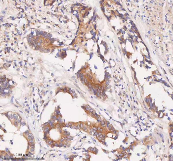 Anti-SAMD9L Antibody