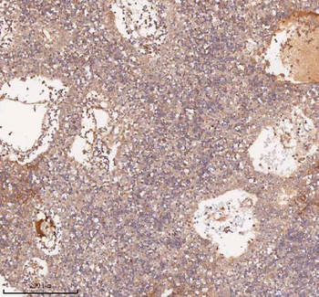 Anti-SAMD9L Antibody