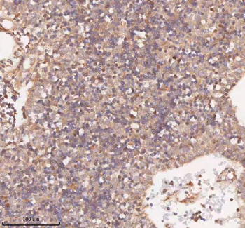 Anti-SAMD9L Antibody