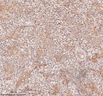 Anti-SAMD9L Antibody