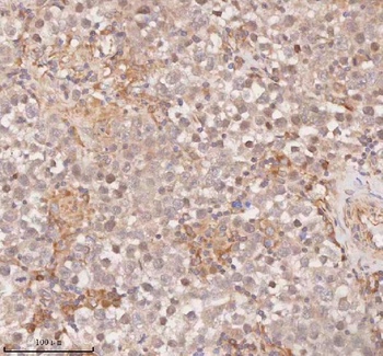 Anti-SAMD9L Antibody