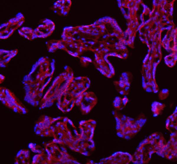 Anti-SAMD9L Antibody