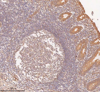 Anti-SAMD9L Antibody