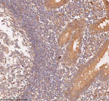 Anti-SAMD9L Antibody