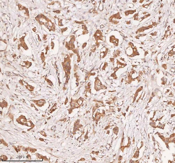 Anti-SAMD9L Antibody