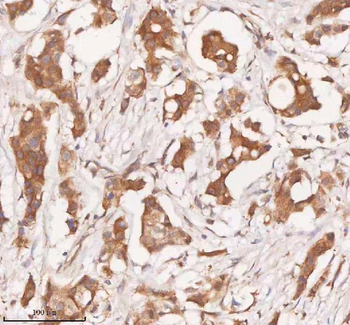 Anti-SAMD9L Antibody