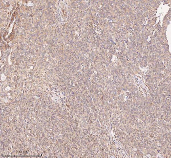 Anti-SAMD9L Antibody