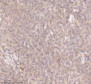 Anti-SAMD9L Antibody