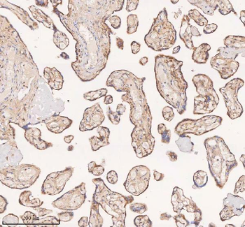 Anti-SAMD9L Antibody