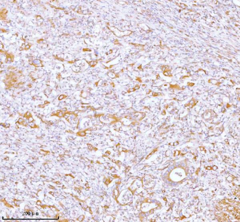 Anti-Stanniocalcin 2/STC2 Antibody