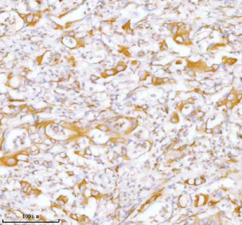 Anti-Stanniocalcin 2/STC2 Antibody