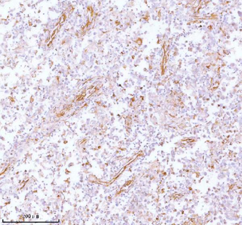Anti-Stanniocalcin 2/STC2 Antibody