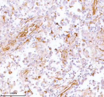 Anti-Stanniocalcin 2/STC2 Antibody