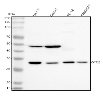 Anti-Stanniocalcin 2/STC2 Antibody
