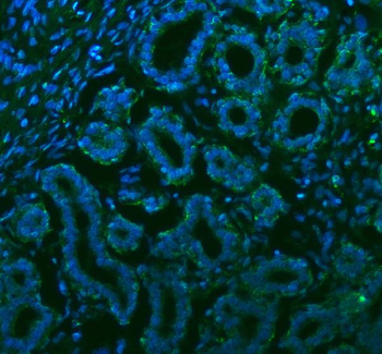 Anti-Stanniocalcin 2/STC2 Antibody