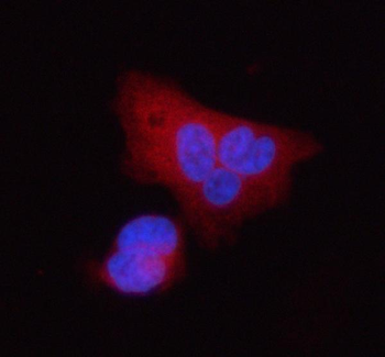 Anti-Stanniocalcin 2/STC2 Antibody