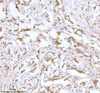 Anti-Stanniocalcin 2/STC2 Antibody