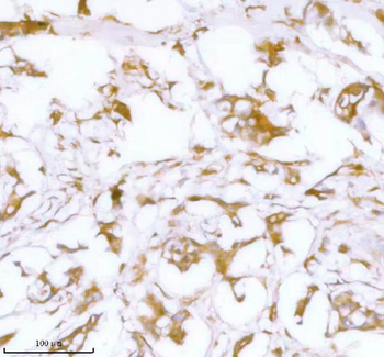 Anti-Stanniocalcin 2/STC2 Antibody