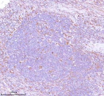 Anti-Stanniocalcin 2/STC2 Antibody
