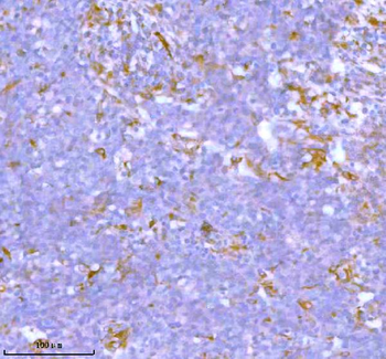 Anti-Stanniocalcin 2/STC2 Antibody