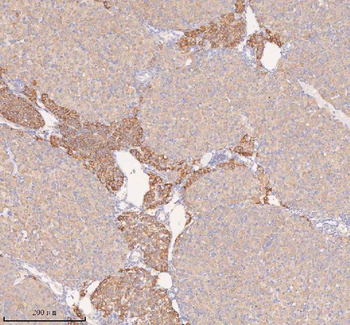 Anti-COQ8B Antibody