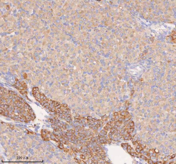 Anti-COQ8B Antibody