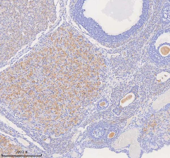 Anti-COQ8B Antibody
