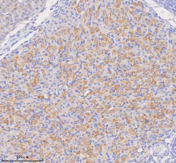 Anti-COQ8B Antibody