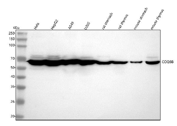 Anti-COQ8B Antibody