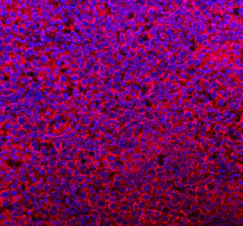 Anti-COQ8B Antibody