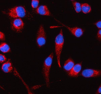 Anti-COQ8B Antibody