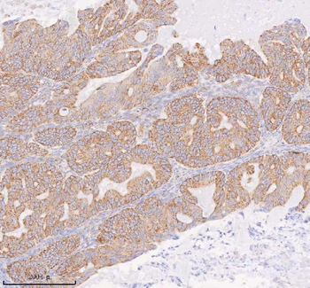 Anti-COQ8B Antibody