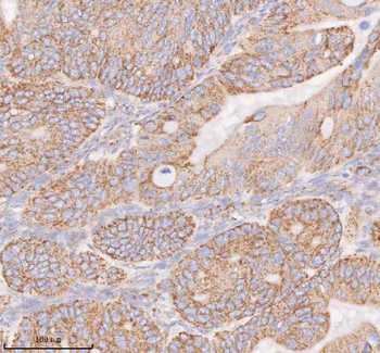 Anti-COQ8B Antibody