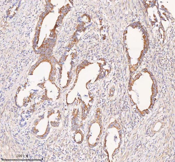 Anti-COQ8B Antibody