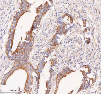 Anti-COQ8B Antibody