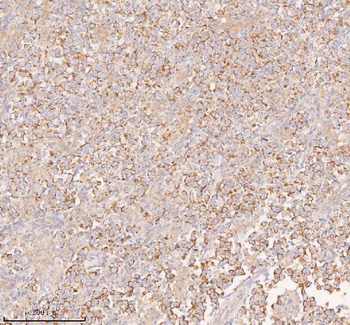 Anti-COQ8B Antibody