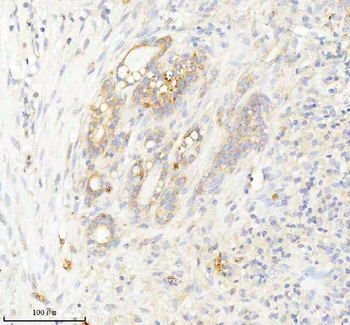 Anti-INTS4 Antibody