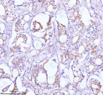 Anti-TNIK Antibody