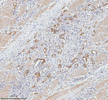 Anti-TNIK Antibody