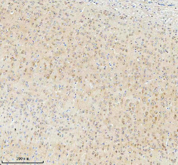Anti-TNIK Antibody