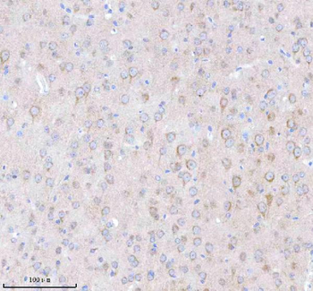 Anti-TNIK Antibody