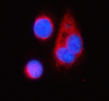 Anti-TNIK Antibody
