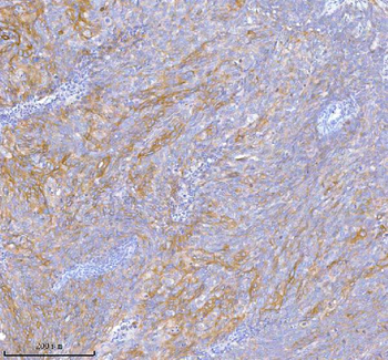 Anti-TNIK Antibody