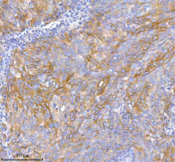 Anti-TNIK Antibody